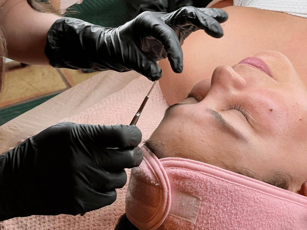 A client receiving a dermaplane facial treatment at Estie Co for smooth and radiant skin.